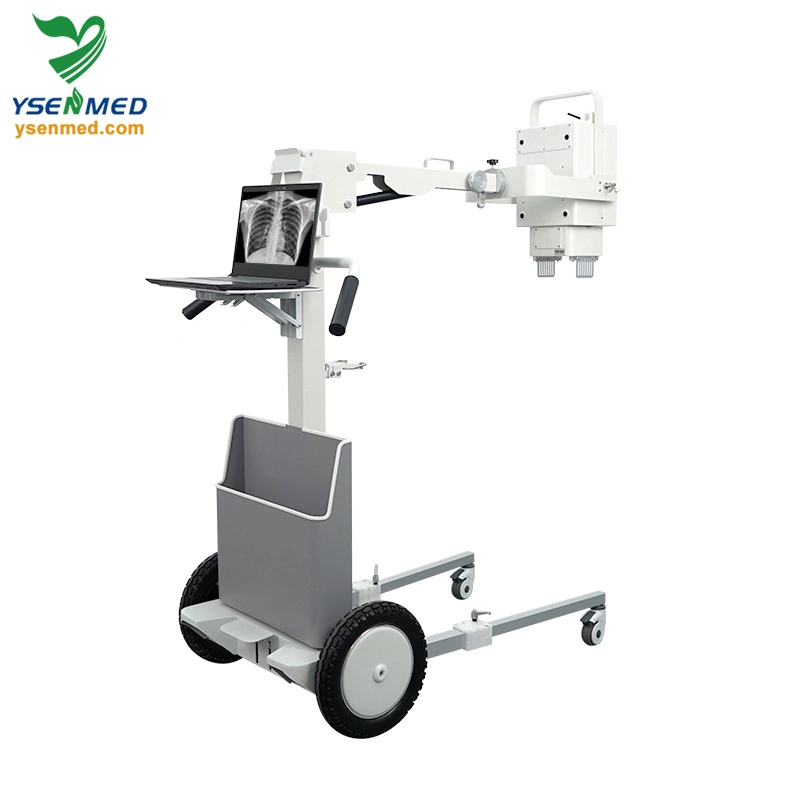 Ysx056-Pd 5.6kw Digital Portable X-ray Machine