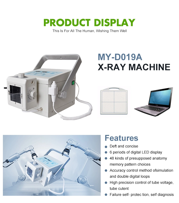 Medical Equipment X-ray Medical Digital High Frequency 4kw Mini Portable X Ray Machine with Dr System